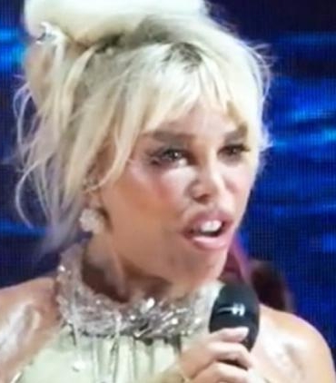 ajda-pekkan-cesme-konserinde-yuz-mimiklerinde-degisim-tartismasi-RRpt8aTb.jpg