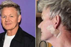 gordon-ramsay-gunese-dikkat-cekti-cilt-kanseri-uyarisi-ve-gunes-koruyucunun-onemi-qv6lPf9A.jpg